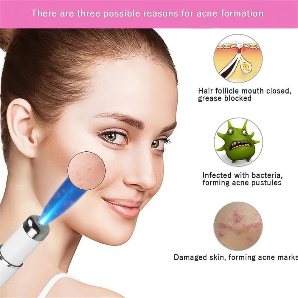 Blue Light Facial Machine Acne Wrinkle Removal Laser Pen Skin Spots Wrinkle Removal Treatment Acne Laser Pen Massage Relax