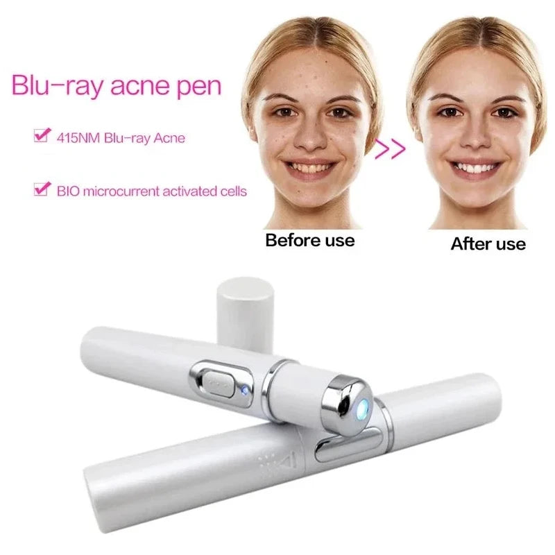 Blue Light Therapy Acne Laser Pen LED Face Light Therapy For Scar Wrinkle Removal Treatment Device Skin Care Beauty Equipment