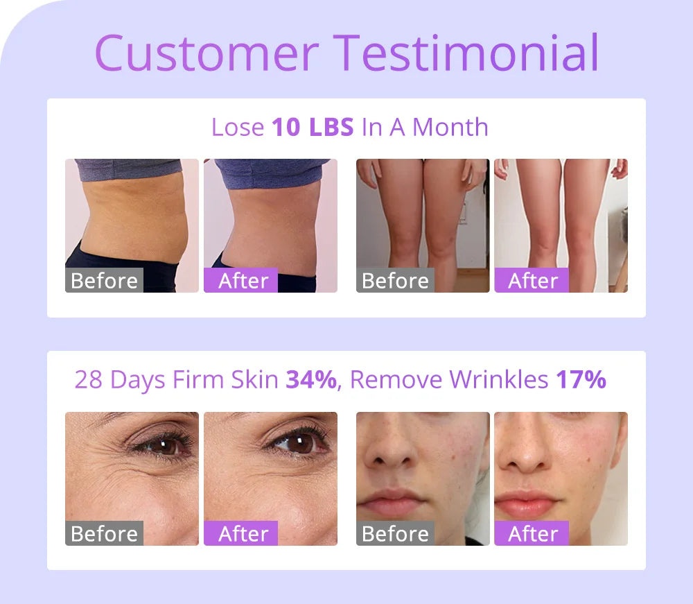 30K Cavitation & RF Machine - Professional for Body and Facial Care (Salon/Spa)