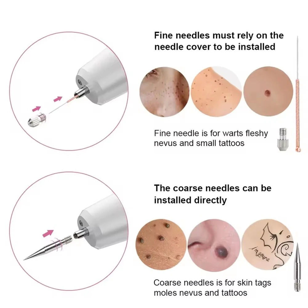 15 Level Plasma Pen Face Cleaner Freckle Black Dot Papilloma Warts Mole Pimples Removal  Blackhead Remover Beauty Skin Care Tool