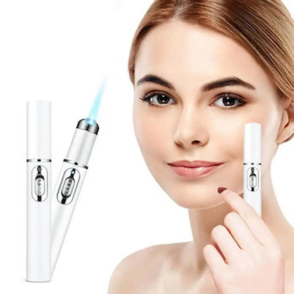 Blue Light Acne Remove Pen For Eliminating Dark Circles And Eye Bags Heating Massage For Swelling Reduction Skin Care Pen