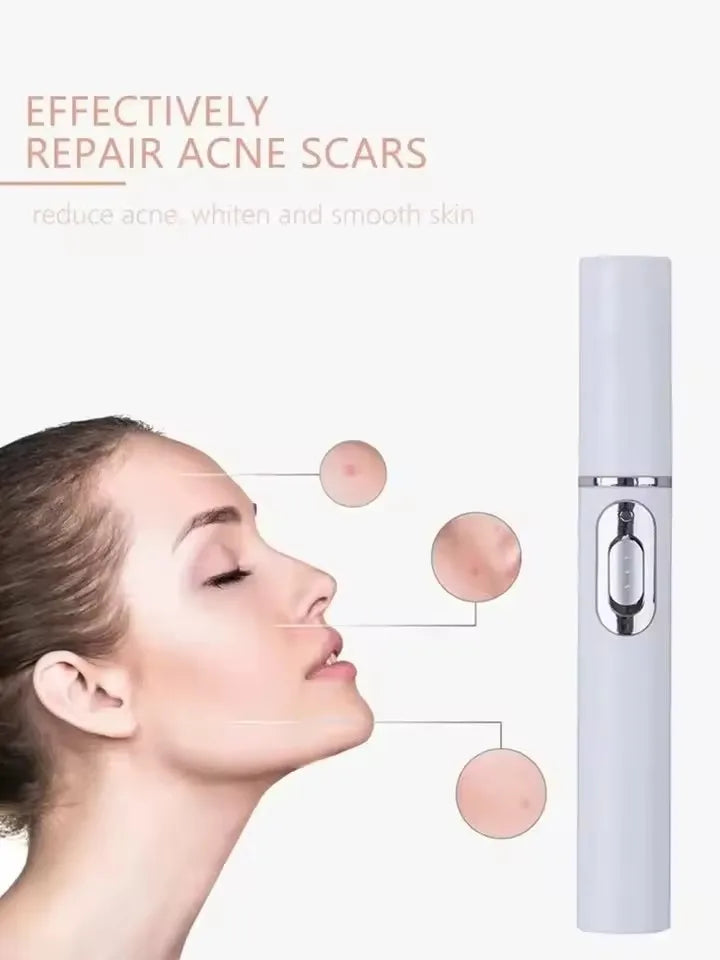 Blue Light Facial Machine Acne Wrinkle Removal Laser Pen Skin Spots Removal Anti Varicose Spider Vein Eraser Medical Treatment