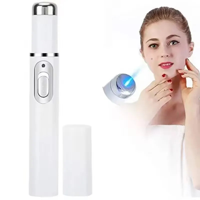 Blue Light Facial Machine Acne Wrinkle Removal Laser Pen Skin Spots Removal Anti Varicose Spider Vein Eraser Medical Treatment