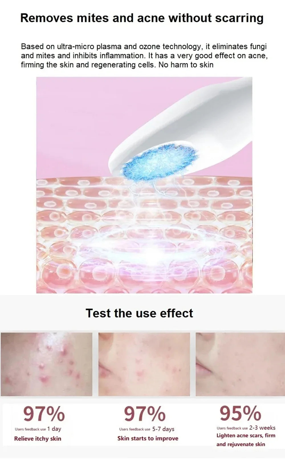 Ozone Cold Plasma Pen Blue Light Acne Removal Sensitive Skin Anti Wrinkle Deep Acne Cleaner Eliminating Acne Shrink Pores Beauty