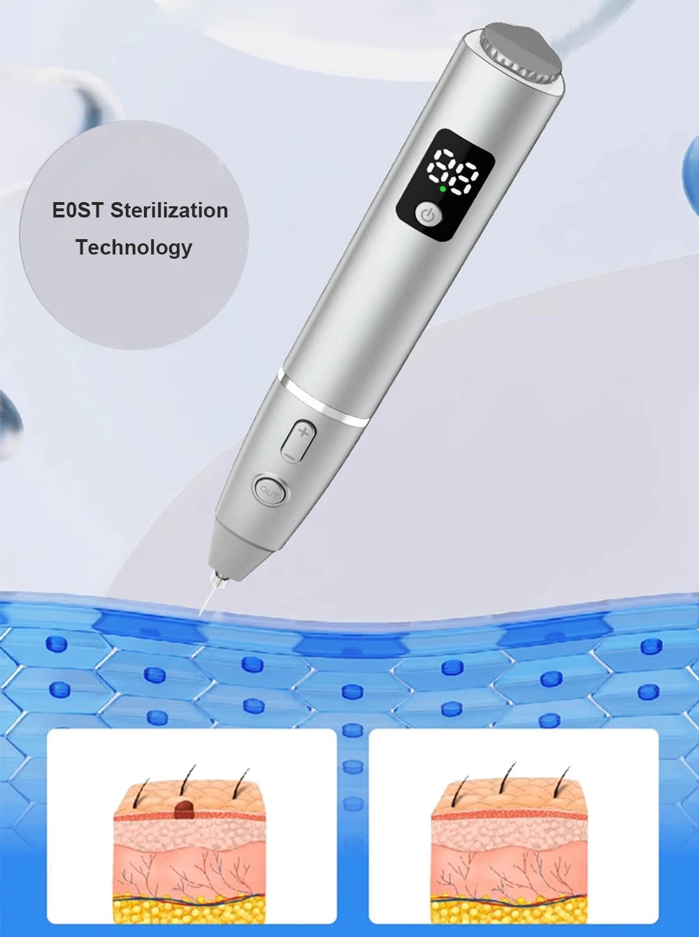 15 Level Plasma Pen Face Cleaner Freckle Black Dot Papilloma Warts Mole Pimples Removal  Blackhead Remover Beauty Skin Care Tool