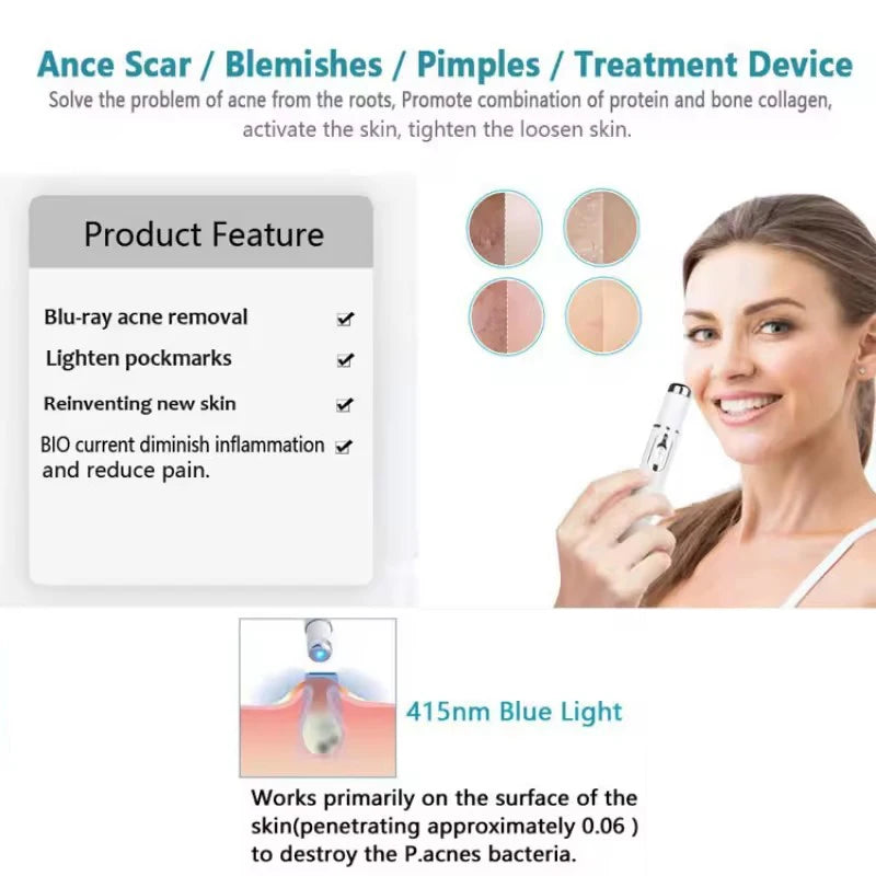 Blue Light Facial Machine Acne Wrinkle Removal Laser Pen Skin Spots Removal Anti Varicose Spider Vein Eraser Medical Treatment