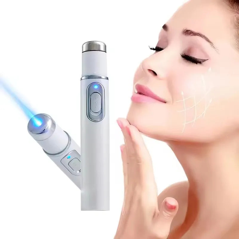 Blue Light Facial Machine Acne Wrinkle Removal Laser Pen Skin Spots Removal Anti Varicose Spider Vein Eraser Medical Treatment
