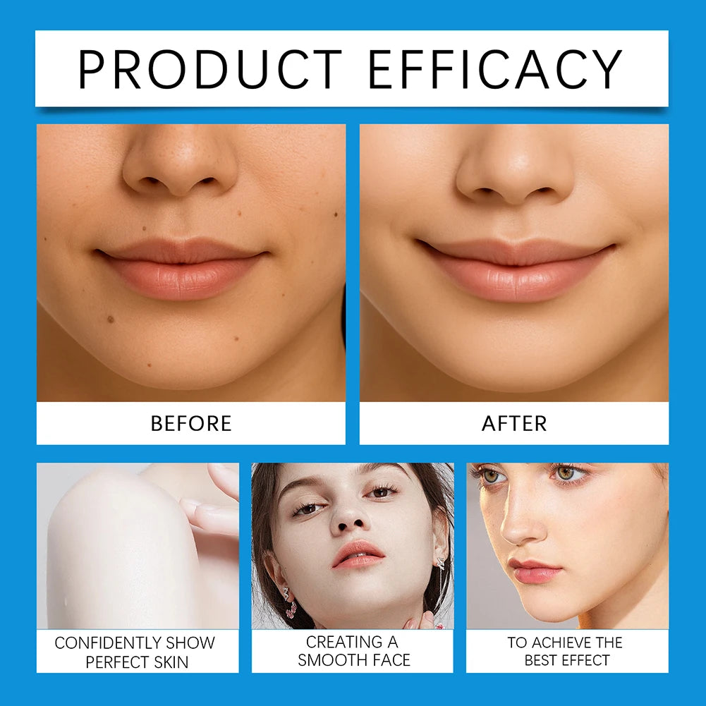 LED Skin Lasers Pen Facial Dark Spot Remover Pimple Extractor Care Tool Skin-Tags Scars Wrinkle Removal Cleaner Daily Skincare