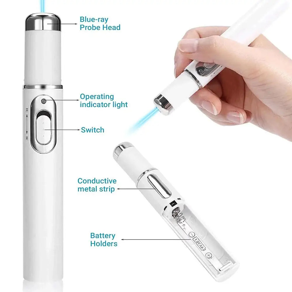 Blue Light Acne Remove Pen For Eliminating Dark Circles And Eye Bags Heating Massage For Swelling Reduction Skin Care Pen