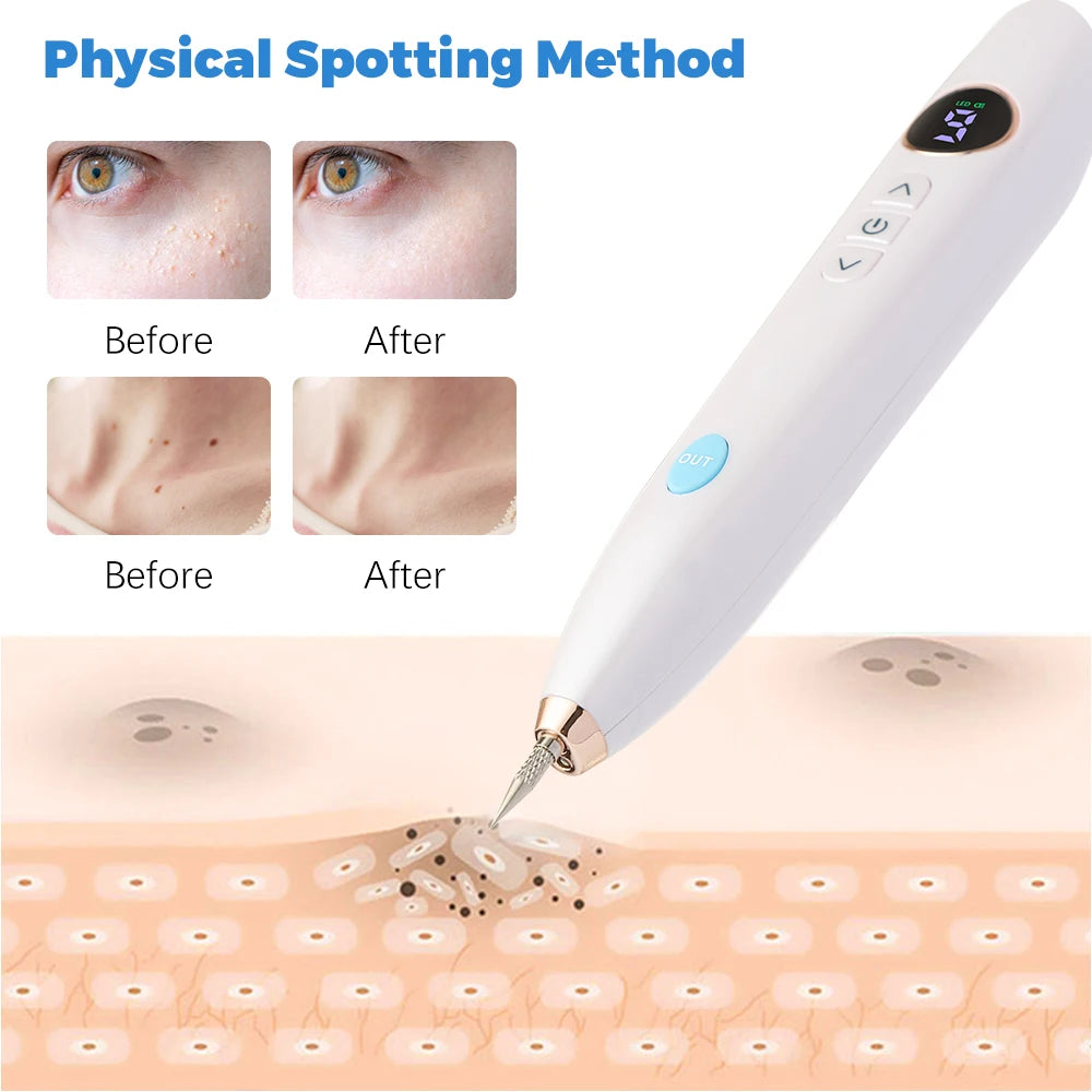 Professional Plasma Pen 9-Level Skin Face Wart Tag Household Black Dots Tattoo Freckle Remover Beauty Instrument LED Screen