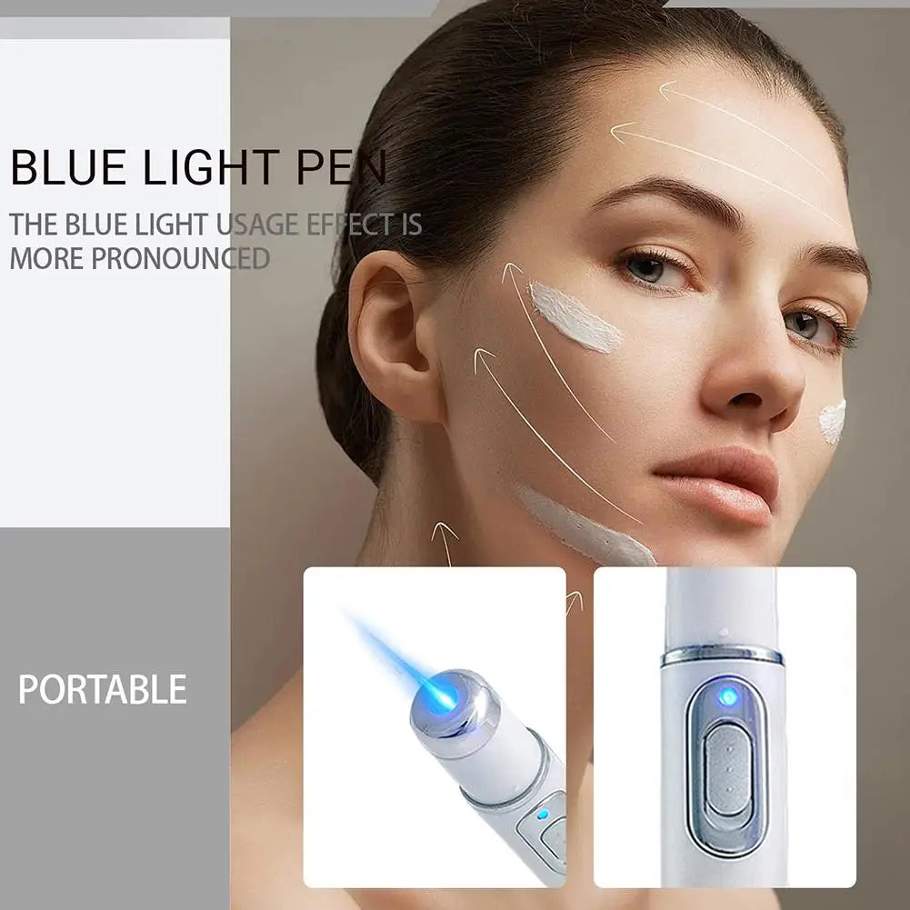 Blue Light Acne Remove Pen For Eliminating Dark Circles And Eye Bags Heating Massage For Swelling Reduction Skin Care Pen