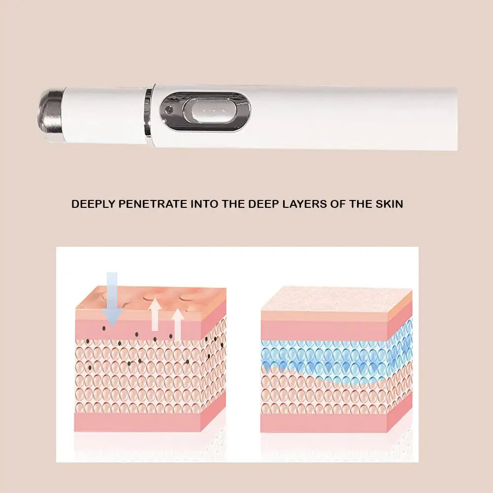Blue Light Acne Remove Pen For Eliminating Dark Circles And Eye Bags Heating Massage For Swelling Reduction Skin Care Pen