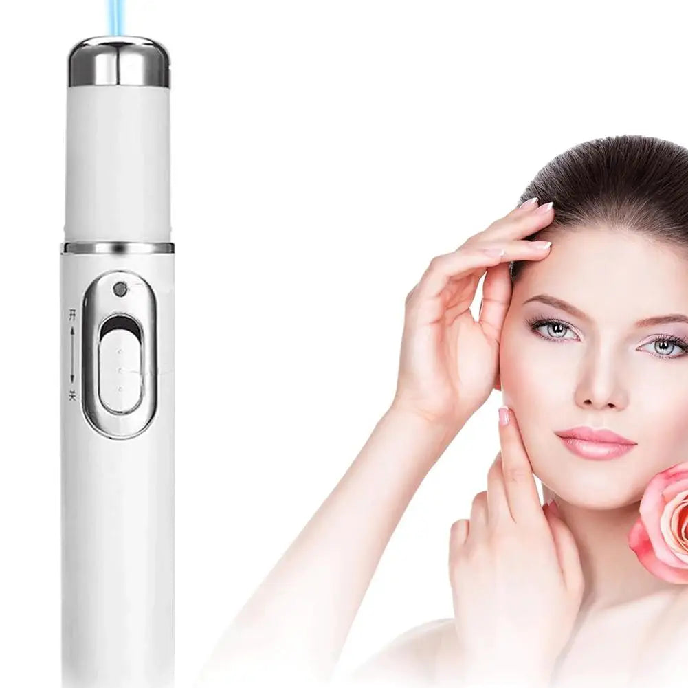 Blue Light Acne Remove Pen For Eliminating Dark Circles And Eye Bags Heating Massage For Swelling Reduction Skin Care Pen