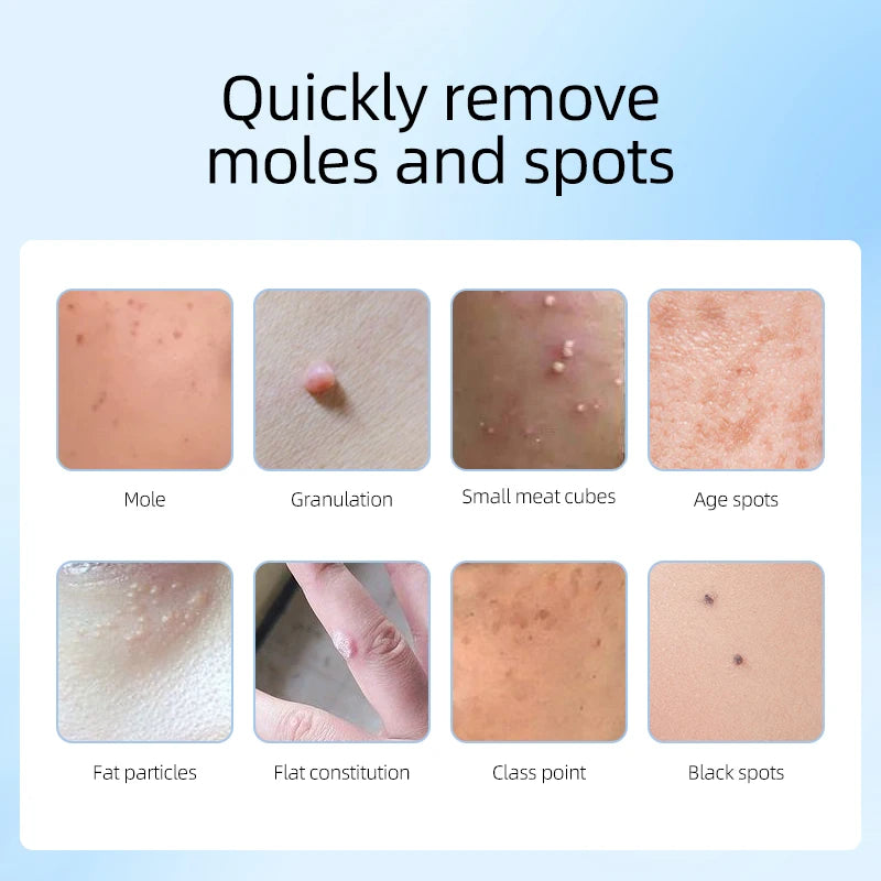 Laser Plasma Pen For Mole Dark Spot Freckle Nevus Wart Skin Tag Pimples Tattoo Removal Skin Face Care Beauty Machine Papilloma