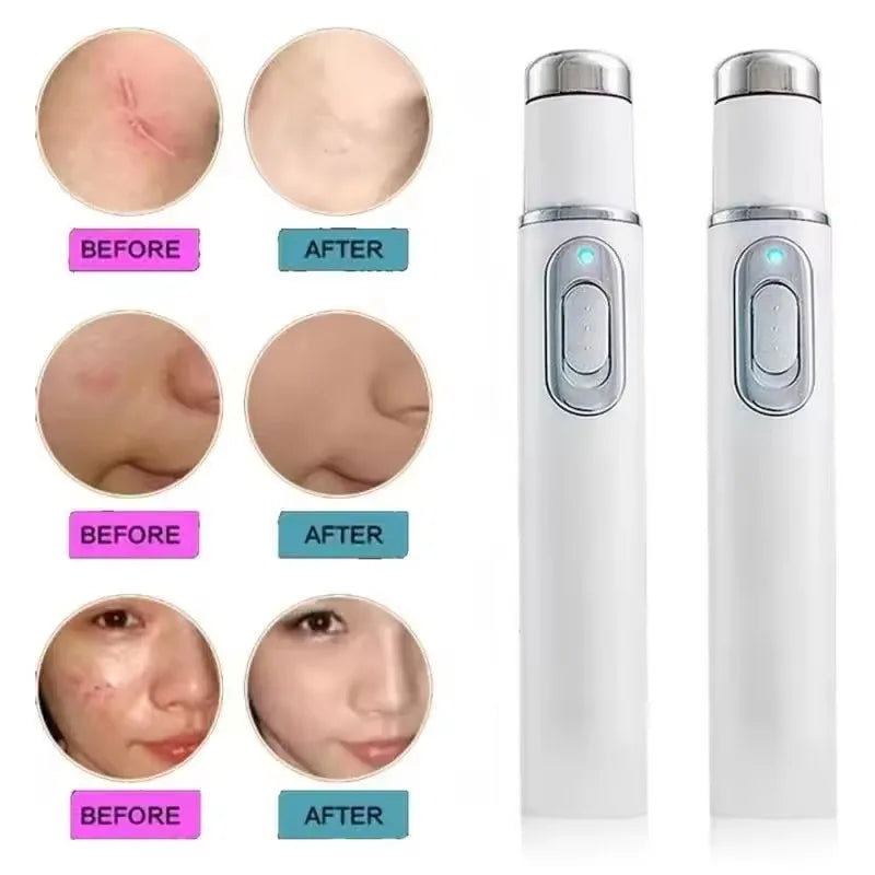 Blue Light Therapy Acne Laser Pen LED Face Light Therapy For Scar Wrinkle Removal Treatment Device Skin Care Beauty Equipment
