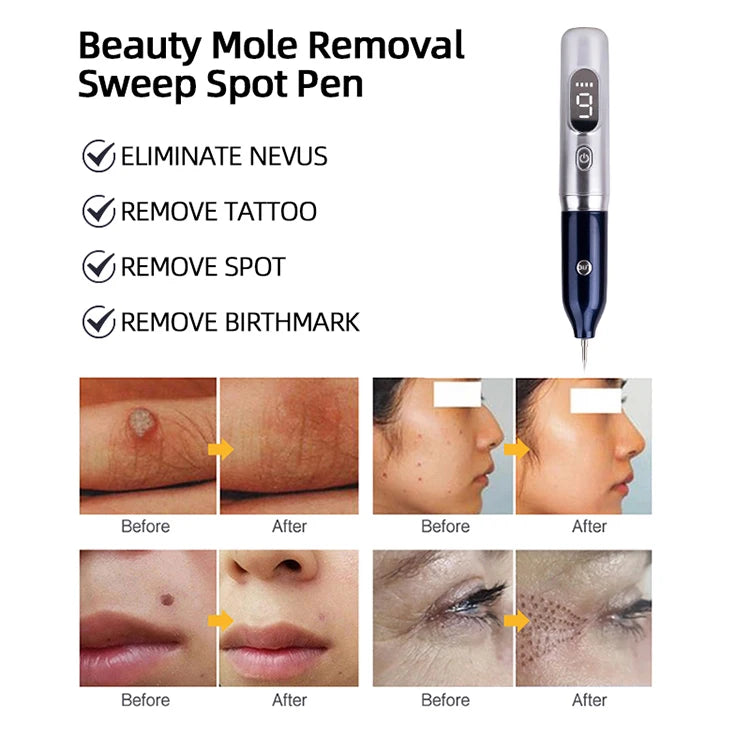 Laser Plasma Pen For Mole Dark Spot Freckle Nevus Wart Skin Tag Pimples Tattoo Removal Skin Face Care Beauty Machine Papilloma