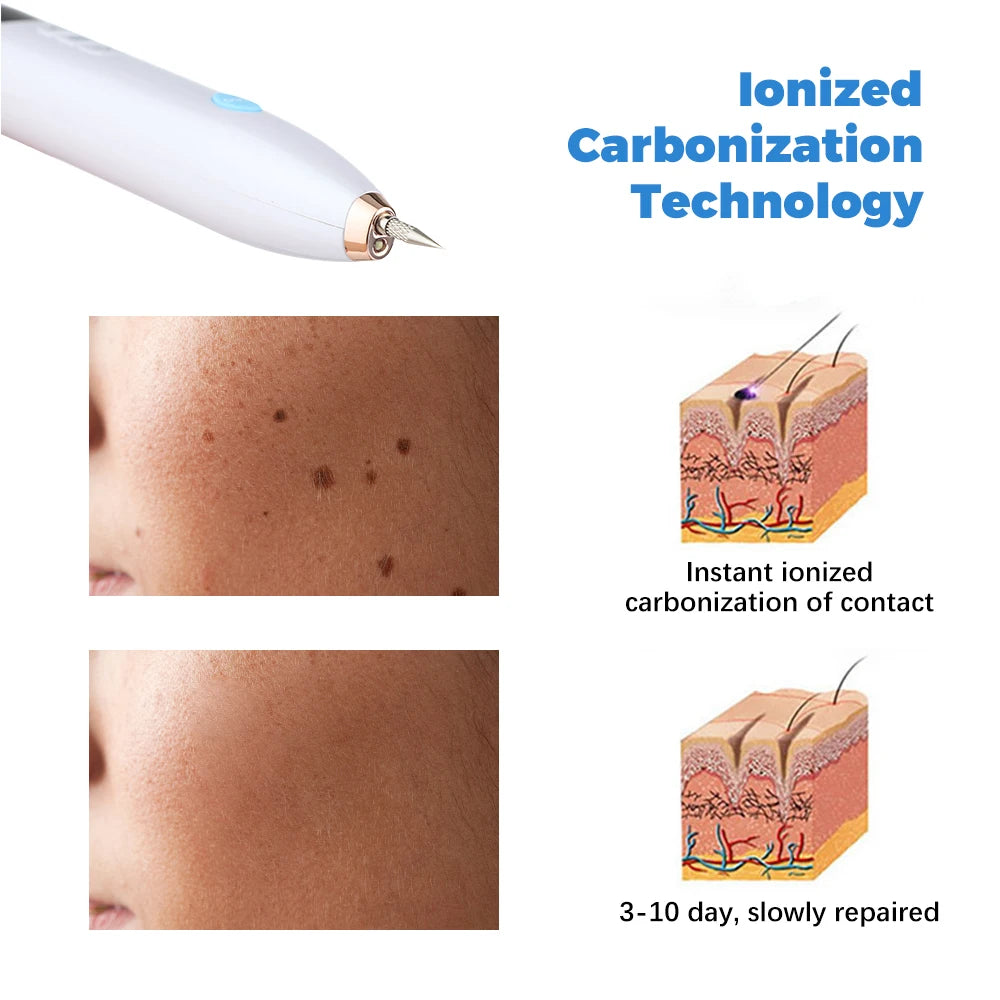 Professional Plasma Pen 9-Level Skin Face Wart Tag Household Black Dots Tattoo Freckle Remover Beauty Instrument LED Screen